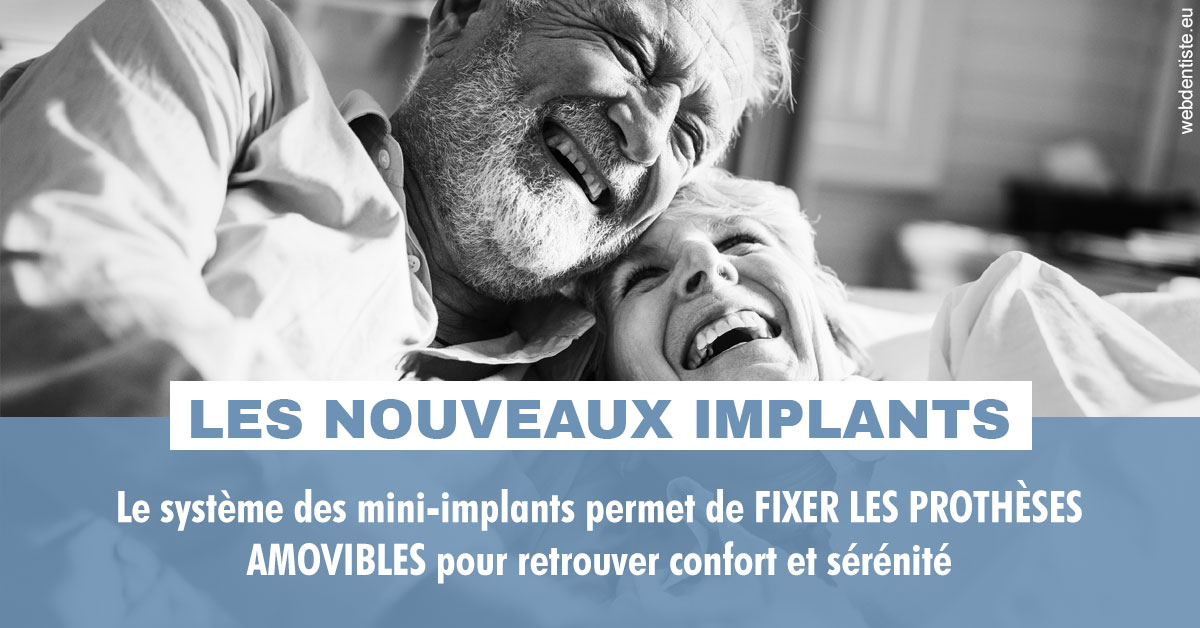 https://dr-eliane-augarten.chirurgiens-dentistes.fr/Les nouveaux implants 2