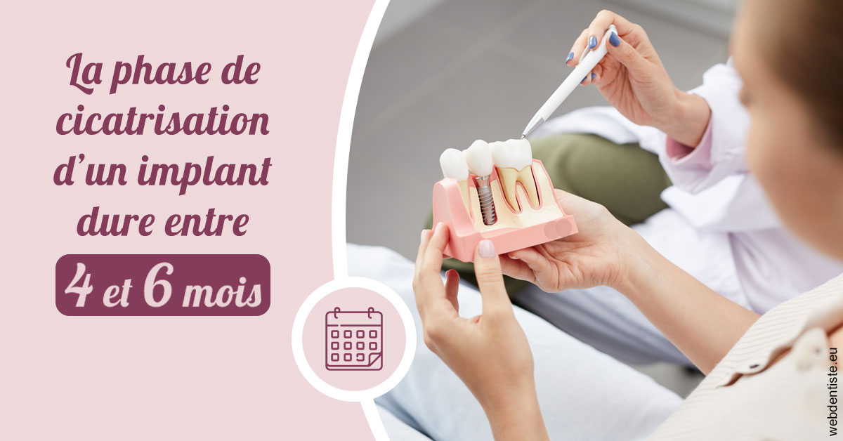 https://dr-eliane-augarten.chirurgiens-dentistes.fr/Cicatrisation implant 2