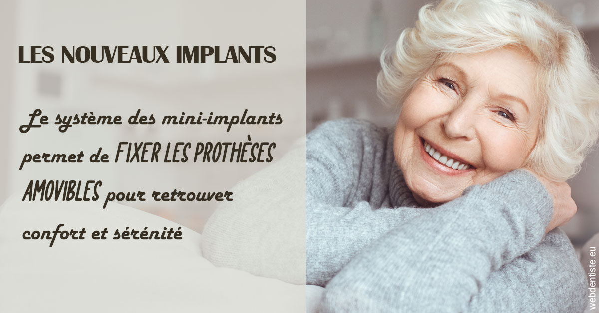 https://dr-eliane-augarten.chirurgiens-dentistes.fr/Les nouveaux implants 1