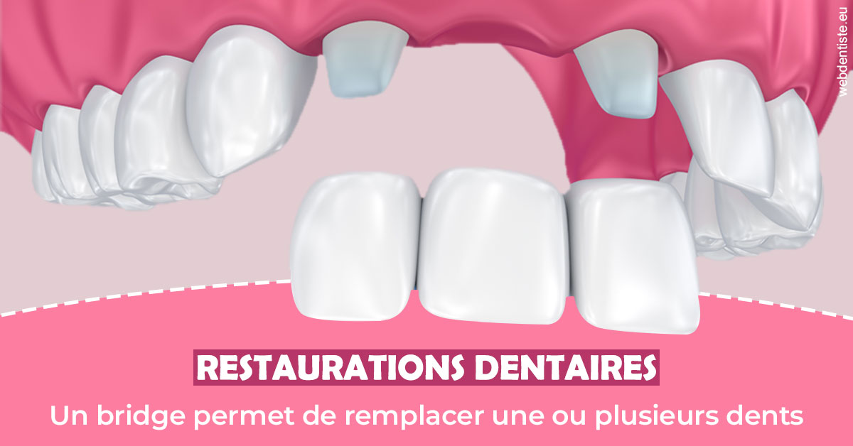 https://dr-eliane-augarten.chirurgiens-dentistes.fr/Bridge remplacer dents 2