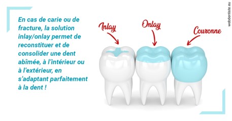 https://dr-eliane-augarten.chirurgiens-dentistes.fr/L'INLAY ou l'ONLAY