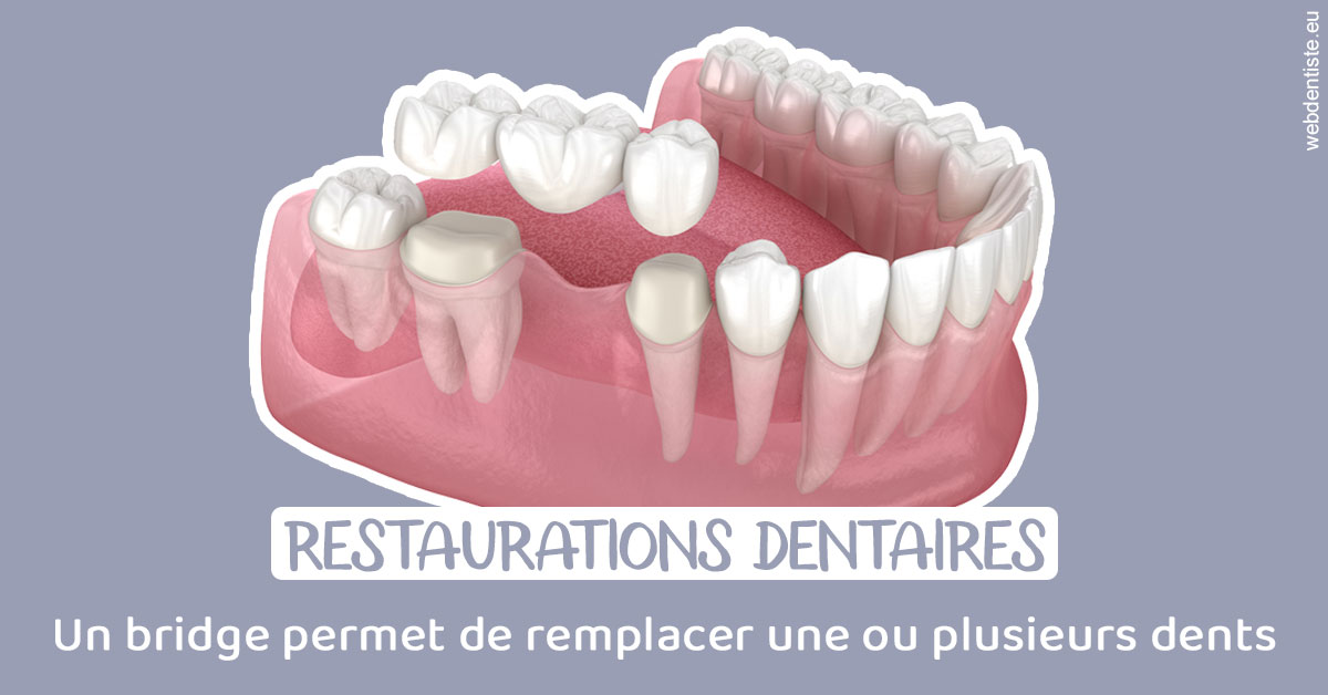 https://dr-eliane-augarten.chirurgiens-dentistes.fr/Bridge remplacer dents 1