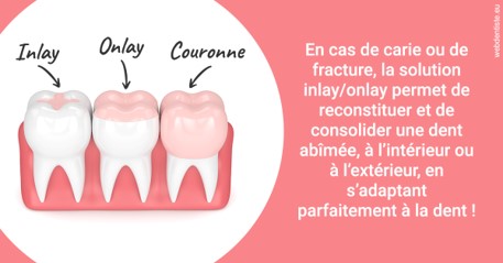 https://dr-eliane-augarten.chirurgiens-dentistes.fr/L'INLAY ou l'ONLAY 2
