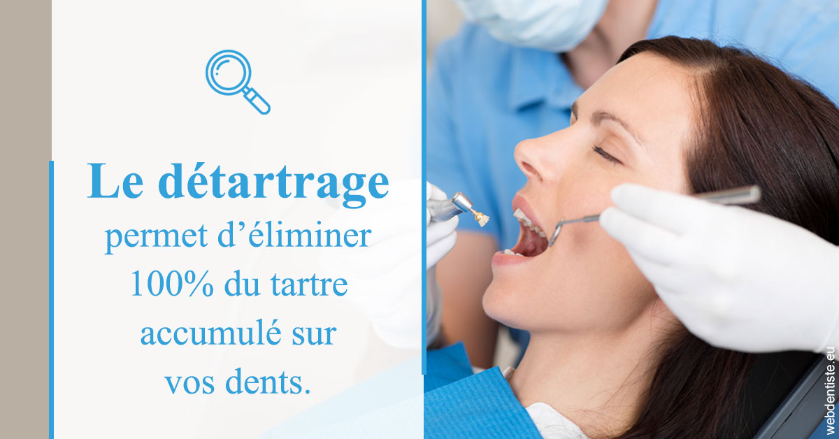 https://dr-eliane-augarten.chirurgiens-dentistes.fr/En quoi consiste le détartrage