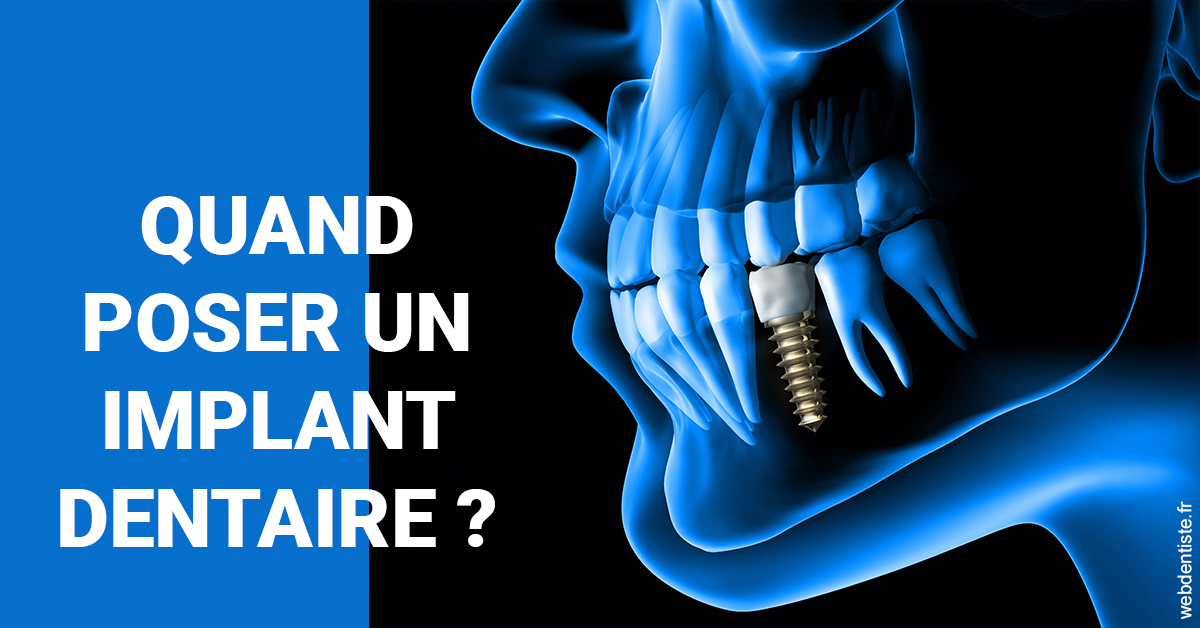 https://dr-eliane-augarten.chirurgiens-dentistes.fr/Les implants 1