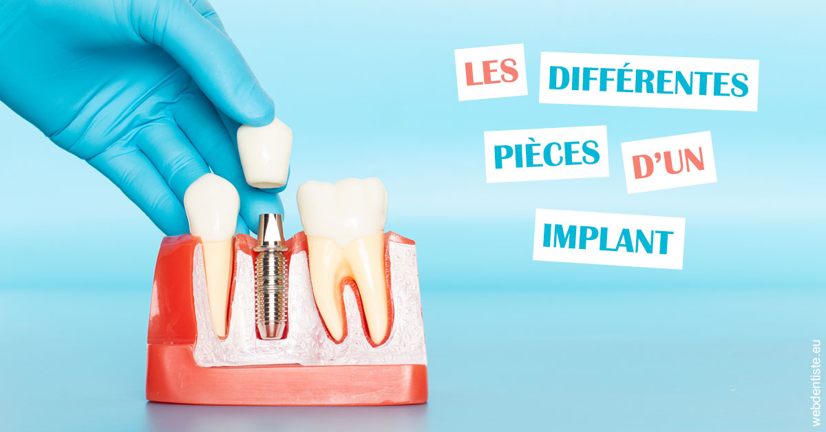 https://dr-eliane-augarten.chirurgiens-dentistes.fr/Les différentes pièces d’un implant 2