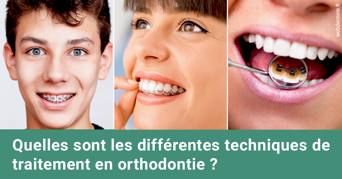https://dr-eliane-augarten.chirurgiens-dentistes.fr/Les différentes techniques de traitement 2