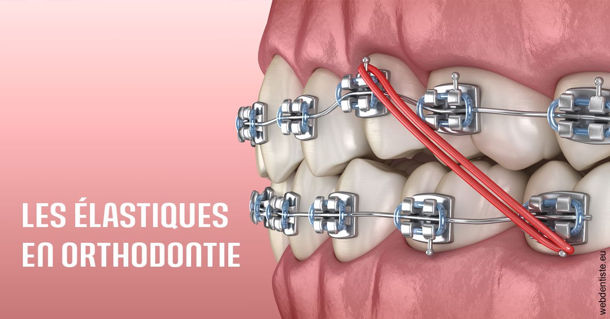 https://dr-eliane-augarten.chirurgiens-dentistes.fr/Elastiques orthodontie 2