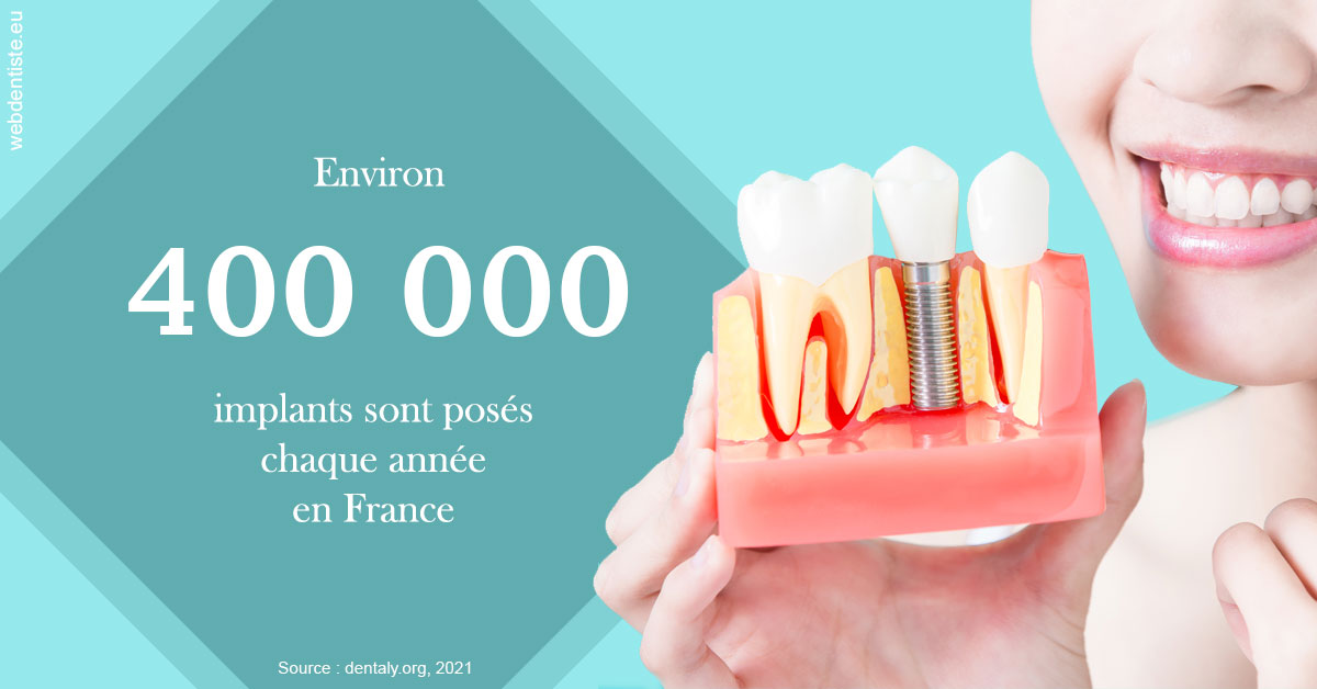 https://dr-eliane-augarten.chirurgiens-dentistes.fr/Pose d'implants en France 2