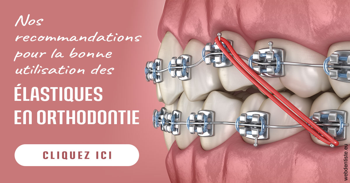 https://dr-eliane-augarten.chirurgiens-dentistes.fr/Elastiques orthodontie 2